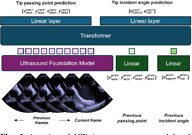 Figure 1 for Guidance for Intra-cardiac Echocardiography Manipulation to Maintain Continuous Therapy Device Tip Visibility