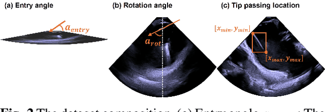 Figure 2 for Guidance for Intra-cardiac Echocardiography Manipulation to Maintain Continuous Therapy Device Tip Visibility