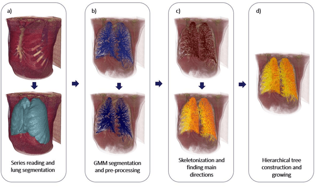 Figure 2 for BRONCO: Automated modelling of the bronchovascular bundle using the Computed Tomography Images