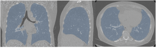 Figure 3 for BRONCO: Automated modelling of the bronchovascular bundle using the Computed Tomography Images