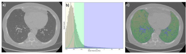 Figure 4 for BRONCO: Automated modelling of the bronchovascular bundle using the Computed Tomography Images