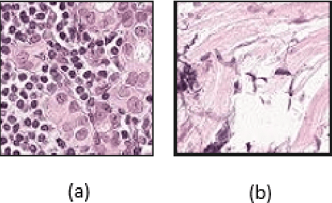 Figure 1 for Histopathological Cancer Detection Using Hybrid Quantum Computing