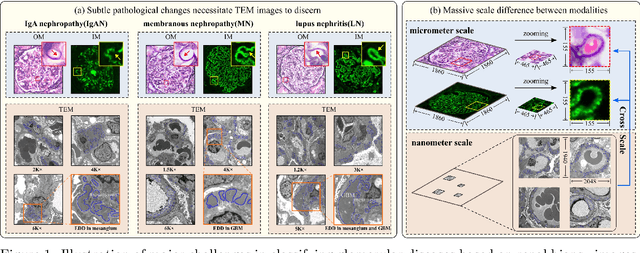 Figure 1 for Cross-modal ultra-scale learning with tri-modalities of renal biopsy images for glomerular multi-disease auxiliary diagnosis