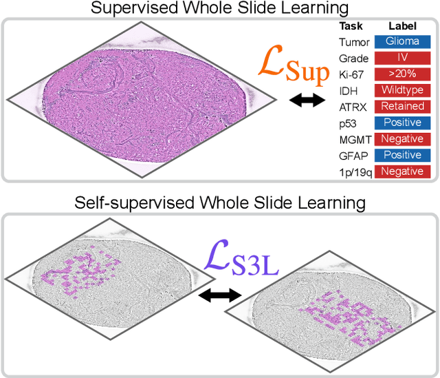 Figure 1 for A self-supervised framework for learning whole slide representations