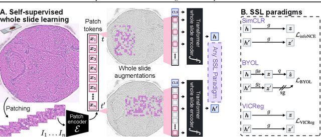 Figure 3 for A self-supervised framework for learning whole slide representations