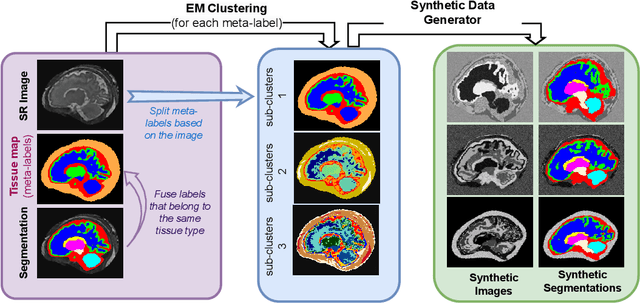 Figure 3 for Maximizing domain generalization in fetal brain tissue segmentation: the role of synthetic data generation, intensity clustering and real image fine-tuning