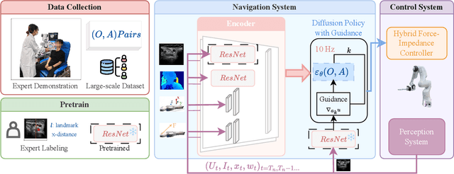 Figure 3 for UltraDP: Generalizable Carotid Ultrasound Scanning with Force-Aware Diffusion Policy