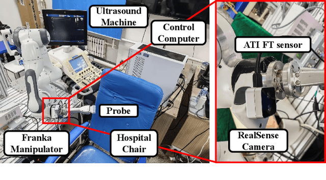 Figure 4 for UltraDP: Generalizable Carotid Ultrasound Scanning with Force-Aware Diffusion Policy