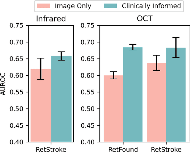 Figure 2 for Multimodal Deep Learning for Stroke Prediction and Detection using Retinal Imaging and Clinical Data