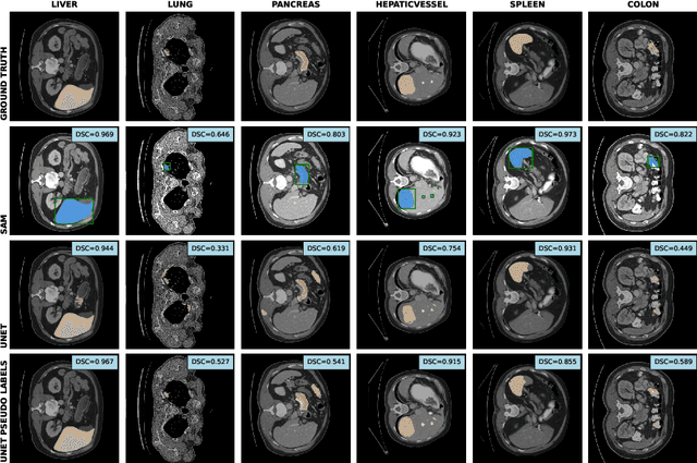 Figure 3 for Medical Image Segmentation with SAM-generated Annotations