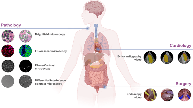 Figure 1 for Biomedical SAM 2: Segment Anything in Biomedical Images and Videos