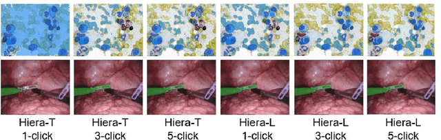 Figure 3 for Biomedical SAM 2: Segment Anything in Biomedical Images and Videos