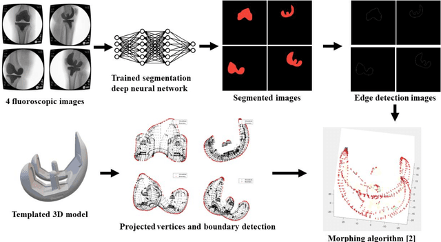 Figure 3 for Enhanced Knee Kinematics: Leveraging Deep Learning and Morphing Algorithms for 3D Implant Modeling