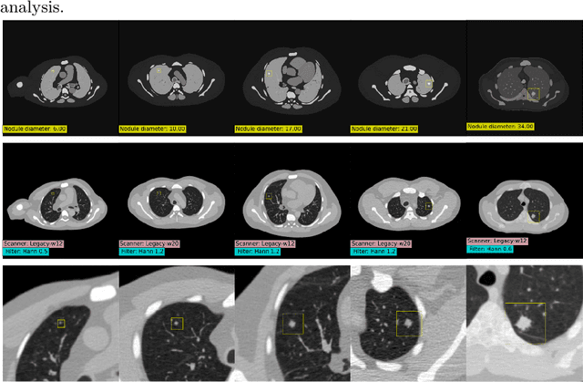 Figure 2 for SYN-LUNGS: Towards Simulating Lung Nodules with Anatomy-Informed Digital Twins for AI Training
