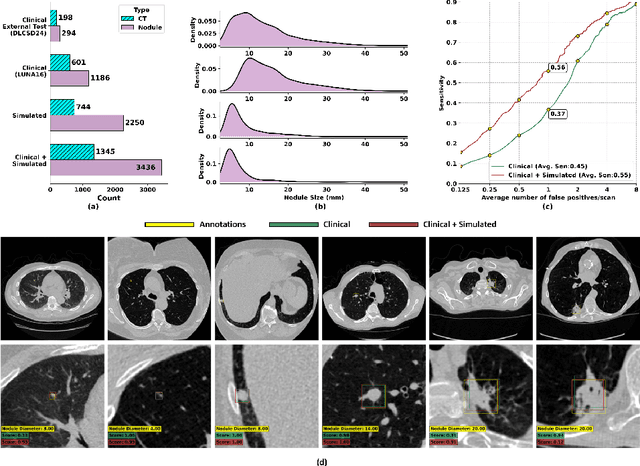 Figure 3 for SYN-LUNGS: Towards Simulating Lung Nodules with Anatomy-Informed Digital Twins for AI Training