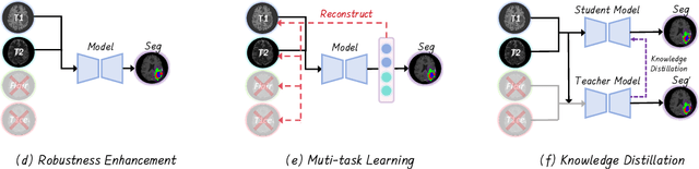 Figure 2 for No Modality Left Behind: Adapting to Missing Modalities via Knowledge Distillation for Brain Tumor Segmentation