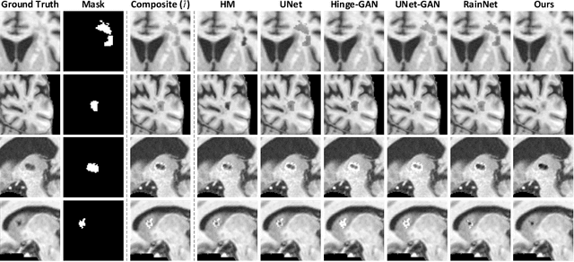 Figure 4 for ARHNet: Adaptive Region Harmonization for Lesion-aware Augmentation to Improve Segmentation Performance