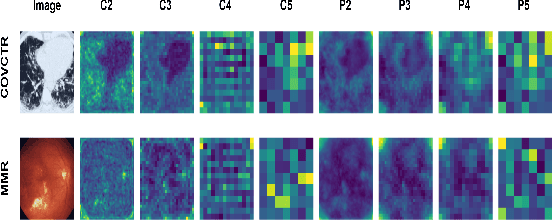 Figure 3 for MicarVLMoE: A Modern Gated Cross-Aligned Vision-Language Mixture of Experts Model for Medical Image Captioning and Report Generation