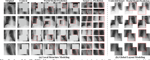 Figure 4 for CheXWorld: Exploring Image World Modeling for Radiograph Representation Learning