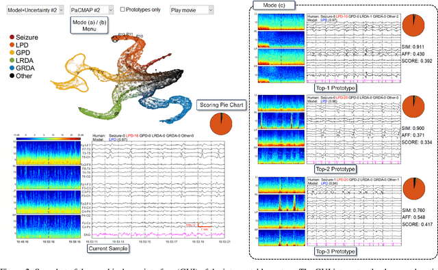 Figure 4 for Mapping the Ictal-Interictal-Injury Continuum Using Interpretable Machine Learning
