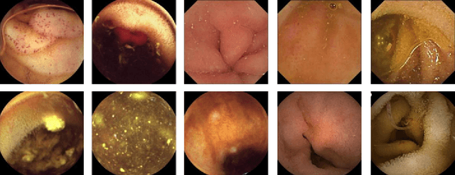 Figure 1 for Capsule Endoscopy Multi-classification via Gated Attention and Wavelet Transformations