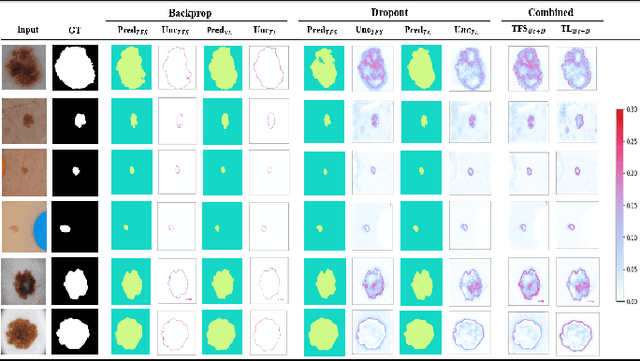 Figure 2 for Uncertainty Quantified Deep Learning and Regression Analysis Framework for Image Segmentation of Skin Cancer Lesions