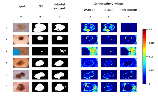 Figure 3 for Uncertainty Quantified Deep Learning and Regression Analysis Framework for Image Segmentation of Skin Cancer Lesions