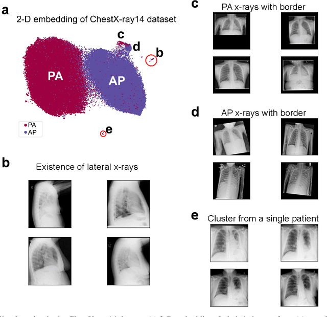 Figure 3 for Outlier Detection in Large Radiological Datasets using UMAP