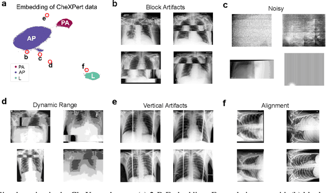 Figure 4 for Outlier Detection in Large Radiological Datasets using UMAP