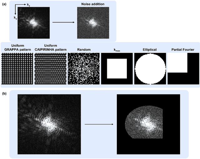 Figure 1 for All-in-One Deep Learning Framework for MR Image Reconstruction