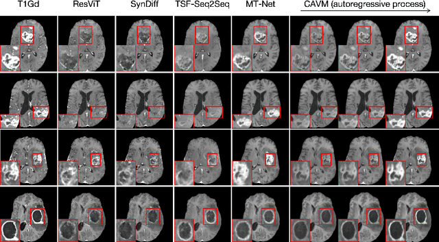Figure 3 for CAVM: Conditional Autoregressive Vision Model for Contrast-Enhanced Brain Tumor MRI Synthesis