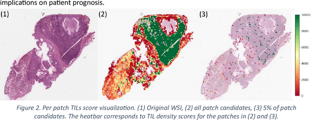 Figure 3 for Fast TILs estimation in lung cancer WSIs based on semi-stochastic patch sampling