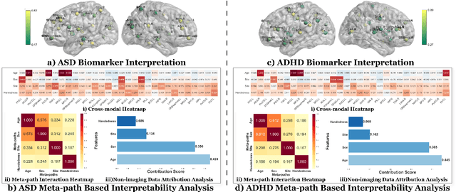 Figure 4 for Information Bottleneck-Guided Heterogeneous Graph Learning for Interpretable Neurodevelopmental Disorder Diagnosis