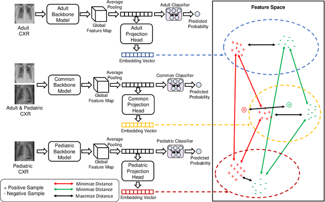 Figure 1 for Improving Pediatric Pneumonia Diagnosis with Adult Chest X-ray Images Utilizing Contrastive Learning and Embedding Similarity