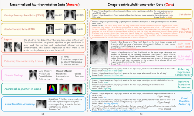 Figure 1 for Enhancing Multi-task Learning Capability of Medical Generalist Foundation Model via Image-centric Multi-annotation Data