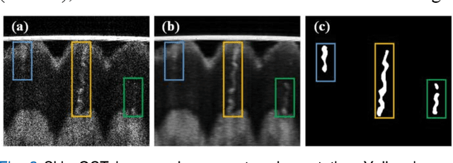 Figure 2 for 3D Deep-learning-based Segmentation of Human Skin Sweat Glands and Their 3D Morphological Response to Temperature Variations