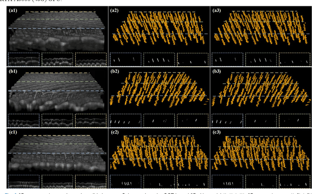 Figure 3 for 3D Deep-learning-based Segmentation of Human Skin Sweat Glands and Their 3D Morphological Response to Temperature Variations