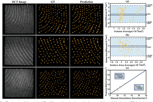 Figure 4 for 3D Deep-learning-based Segmentation of Human Skin Sweat Glands and Their 3D Morphological Response to Temperature Variations