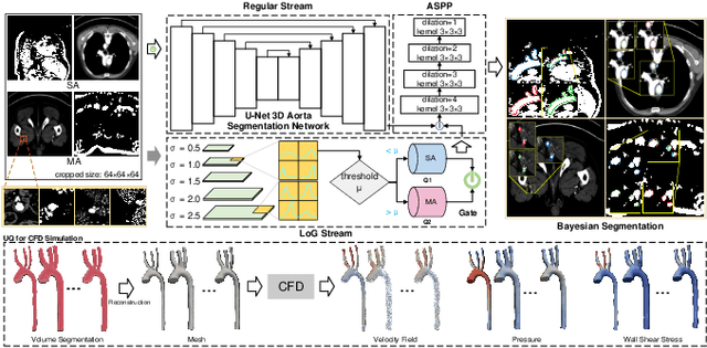 Figure 1 for Hierarchical LoG Bayesian Neural Network for Enhanced Aorta Segmentation