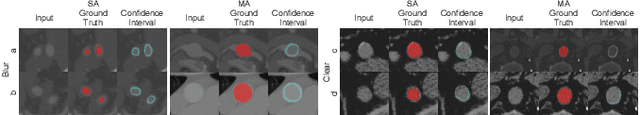 Figure 3 for Hierarchical LoG Bayesian Neural Network for Enhanced Aorta Segmentation