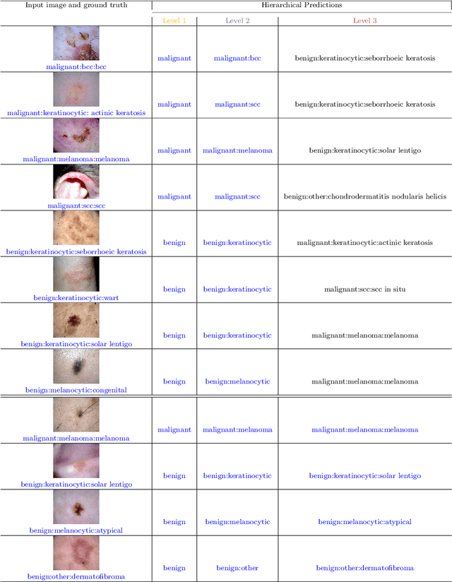 Figure 2 for Revamping AI Models in Dermatology: Overcoming Critical Challenges for Enhanced Skin Lesion Diagnosis