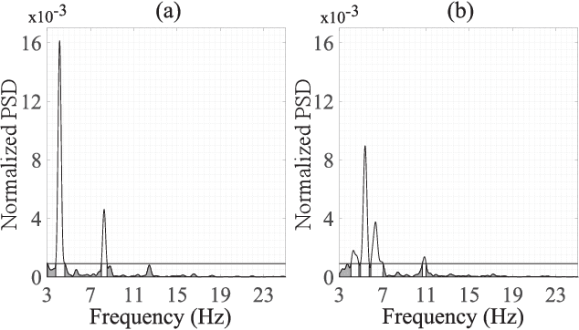 Figure 1 for Spectral Distribution Complexity of the Surface Fibrillatory Waves Predicts Post-Catheter Ablation Relapse in Persistent Atrial Fibrillation
