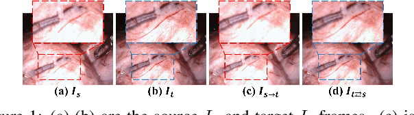 Figure 1 for MonoPCC: Photometric-invariant Cycle Constraint for Monocular Depth Estimation of Endoscopic Images