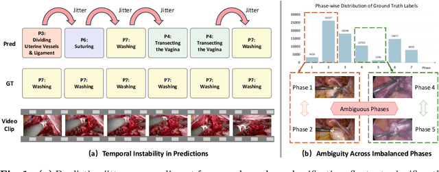 Figure 1 for DSTED: Decoupling Temporal Stabilization and Discriminative Enhancement for Surgical Workflow Recognition