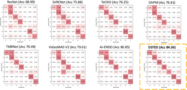 Figure 4 for DSTED: Decoupling Temporal Stabilization and Discriminative Enhancement for Surgical Workflow Recognition