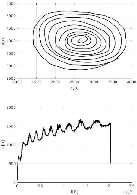 Figure 3 for Evaluation of handwriting kinematics and pressure for differential diagnosis of Parkinson's disease