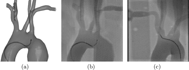 Figure 1 for Translating Simulation Images to X-ray Images via Multi-Scale Semantic Matching