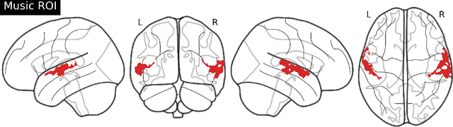 Figure 4 for R&B -- Rhythm and Brain: Cross-subject Decoding of Music from Human Brain Activity
