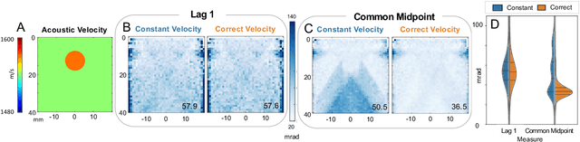 Figure 1 for Ultrasound Autofocusing: Common Midpoint Phase Error Optimization via Differentiable Beamforming