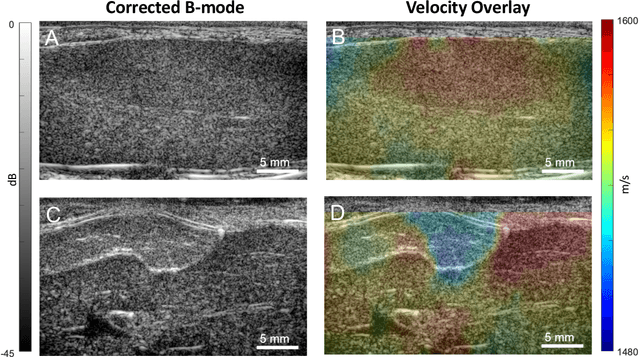 Figure 4 for Ultrasound Autofocusing: Common Midpoint Phase Error Optimization via Differentiable Beamforming